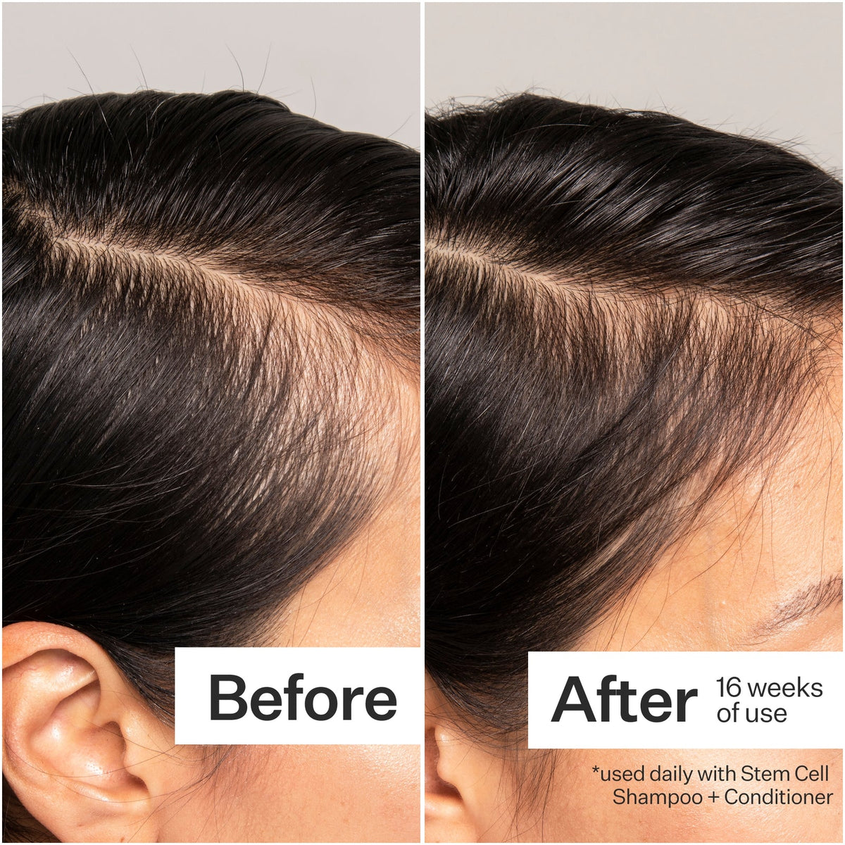 Act+Acre Cold Processed® 3% Stem Cell Peptide Treatment – 3 oz - image 3