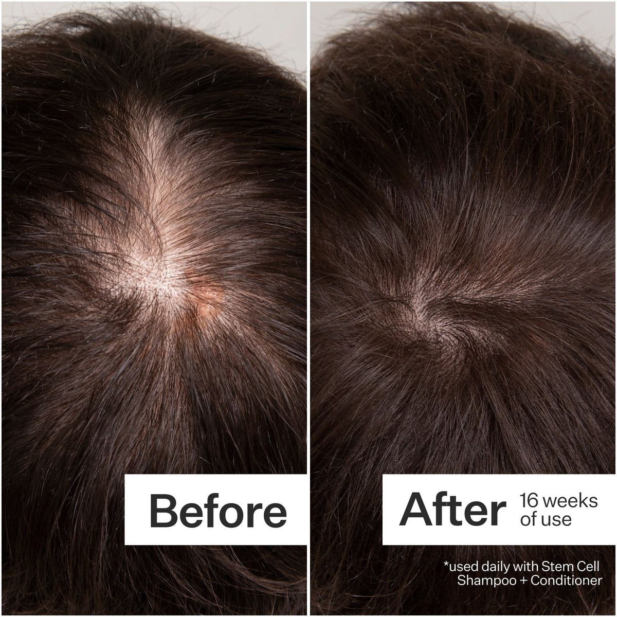 Act+Acre Cold Processed® 3% Stem Cell Peptide Treatment – 3 oz - image 1